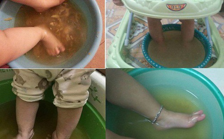 Con sốt 40 độ, mẹ được khuyên dùng lươn hạ nhiệt