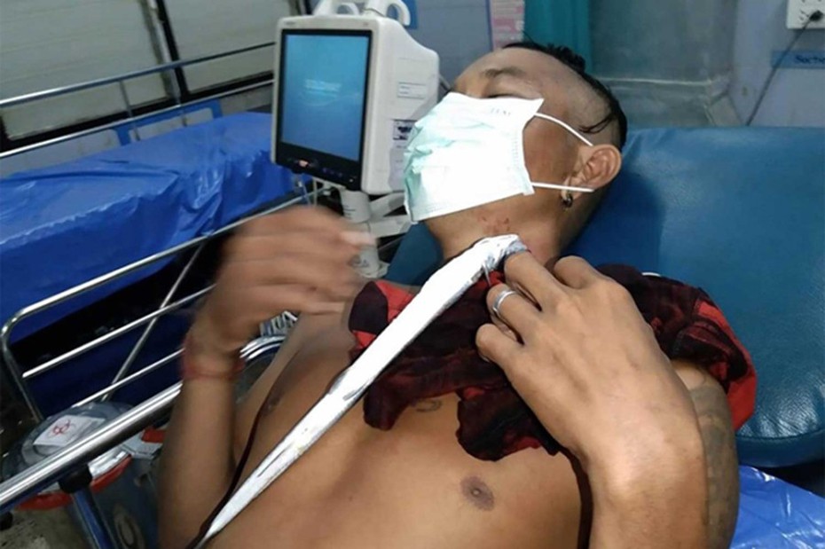 Cá đâm thủng cổ du khách tắm biển