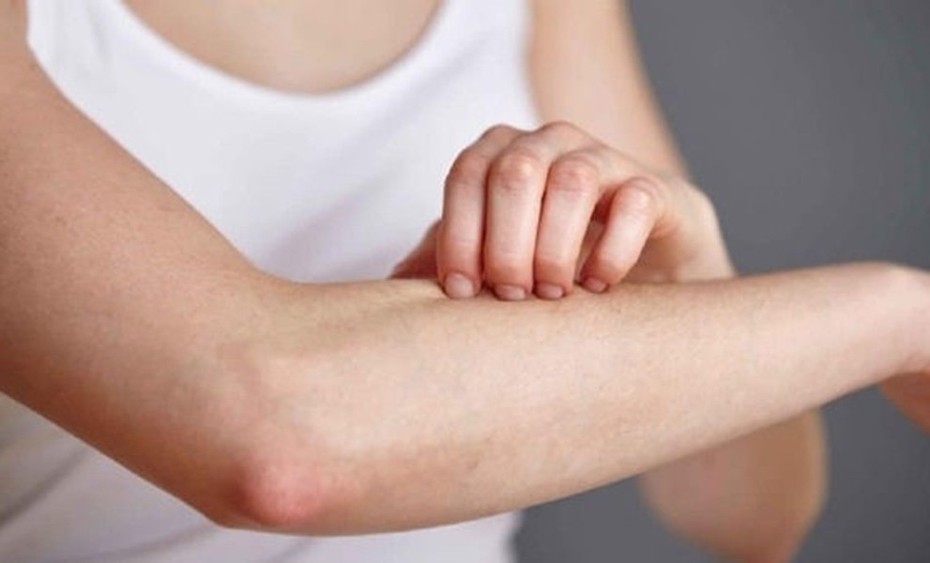 Bị ngứa ở những vùng này, cẩn thận mắc ung thư mà không biết
