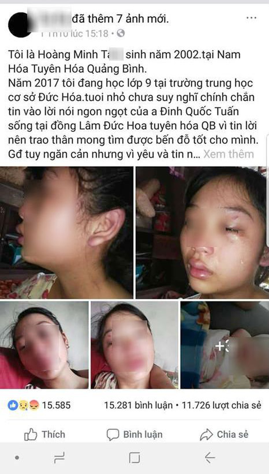 Vụ cô gái 16 tuổi tố bị chồng đánh: Người chồng có thể bị truy cứu tội Giao cấu với trẻ em