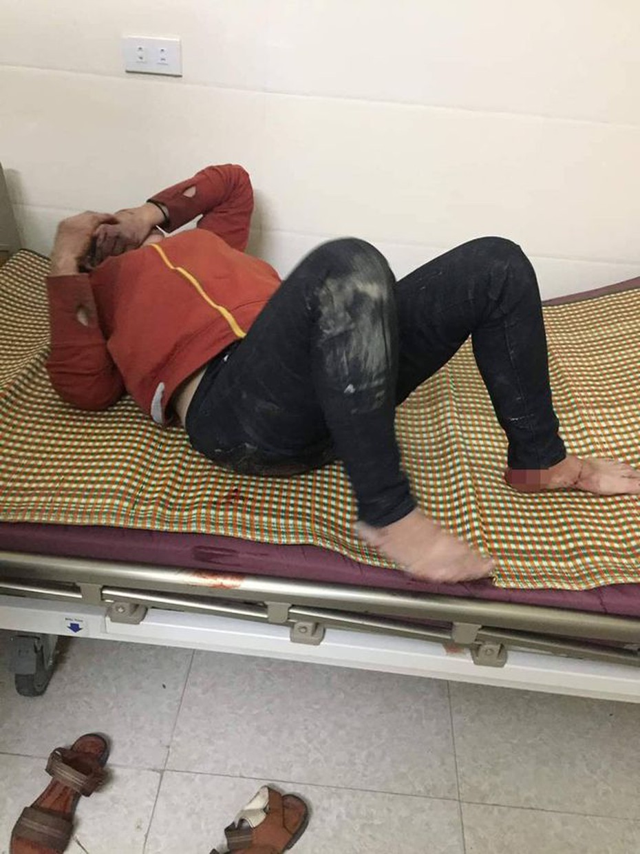 Bắt “phi công trẻ” dùng thanh sắt đâm vào vùng kín của người tình lớn tuổi
