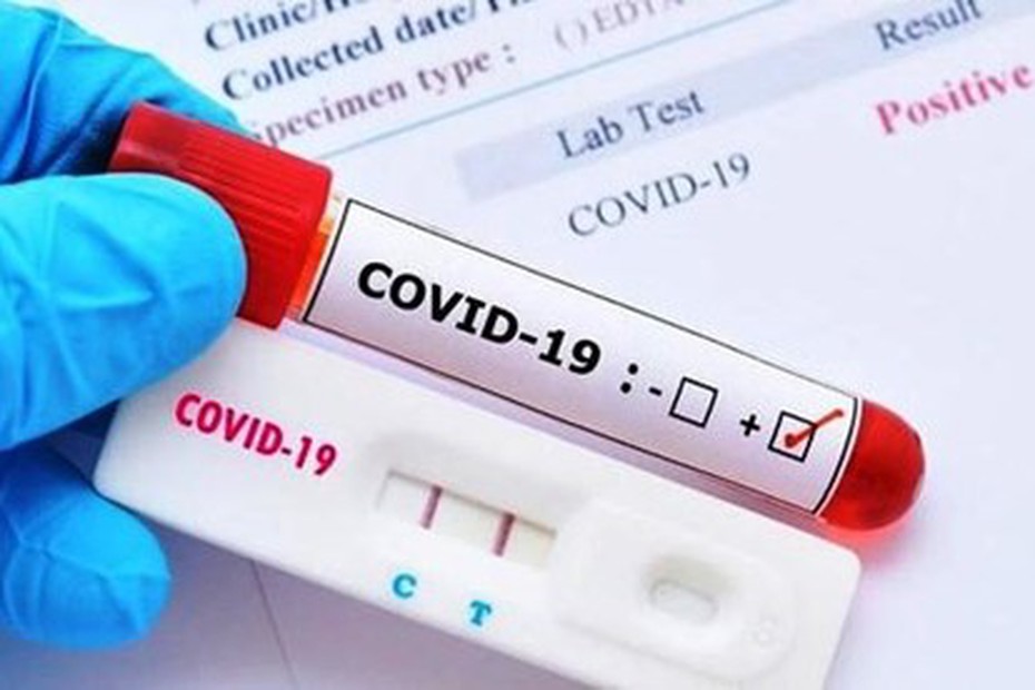 Phát hiện hàng loạt bộ kít test Covid-19, khẩu trang, mặt nạ thở oxy không rõ xuất xứ