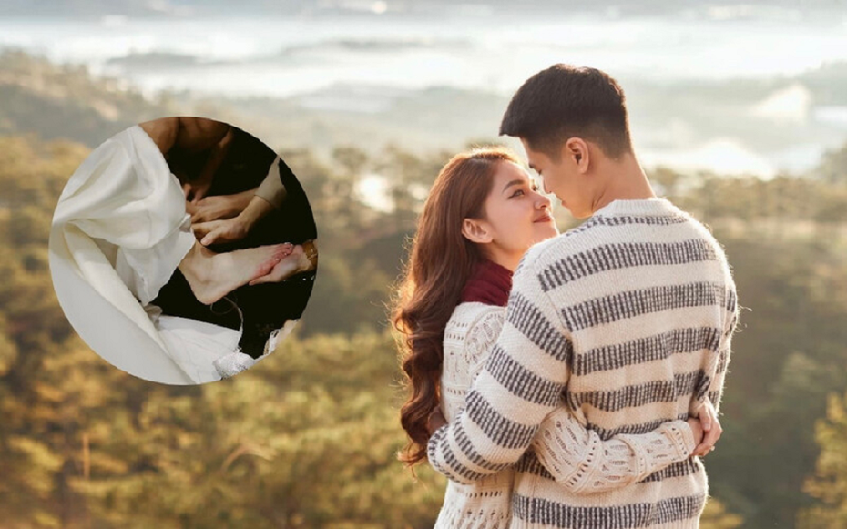 Á hậu Thùy Dung gặp sự cố trong đám cưới đến mức đi lại rất khó khăn