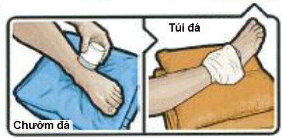 4 nên, 4 tránh khi chấn thương phần mềm