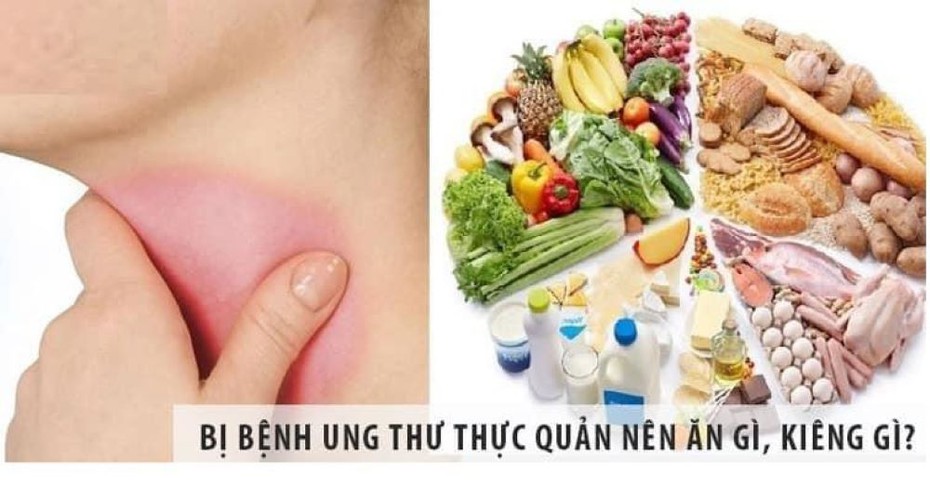 9 dấu hiệu giúp bạn nhận biết ung thư thực quản sớm nhất