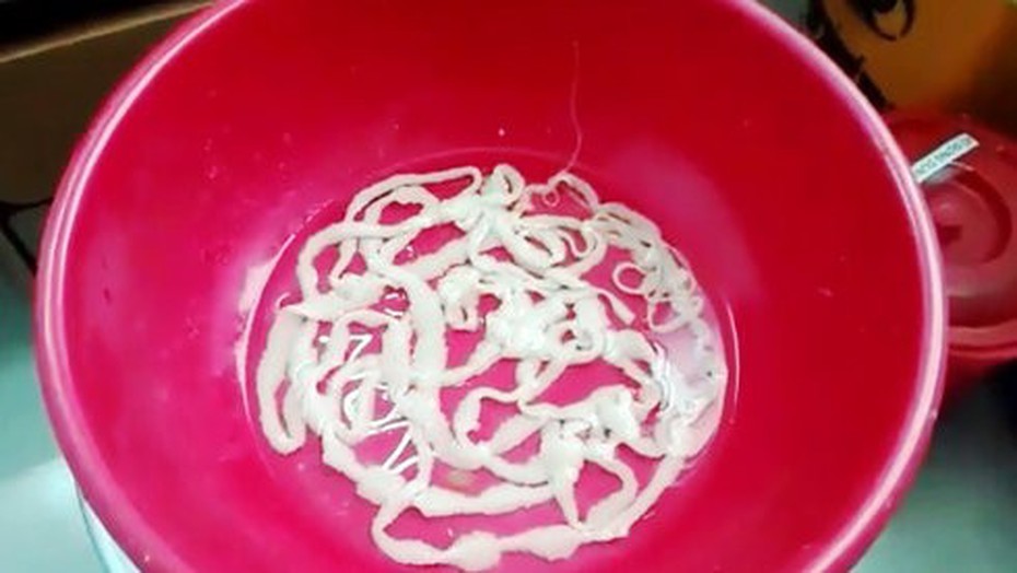 Sán xơ mít dài hơn 8m "làm tổ" trong người: Có nên tẩy sán tại nhà?