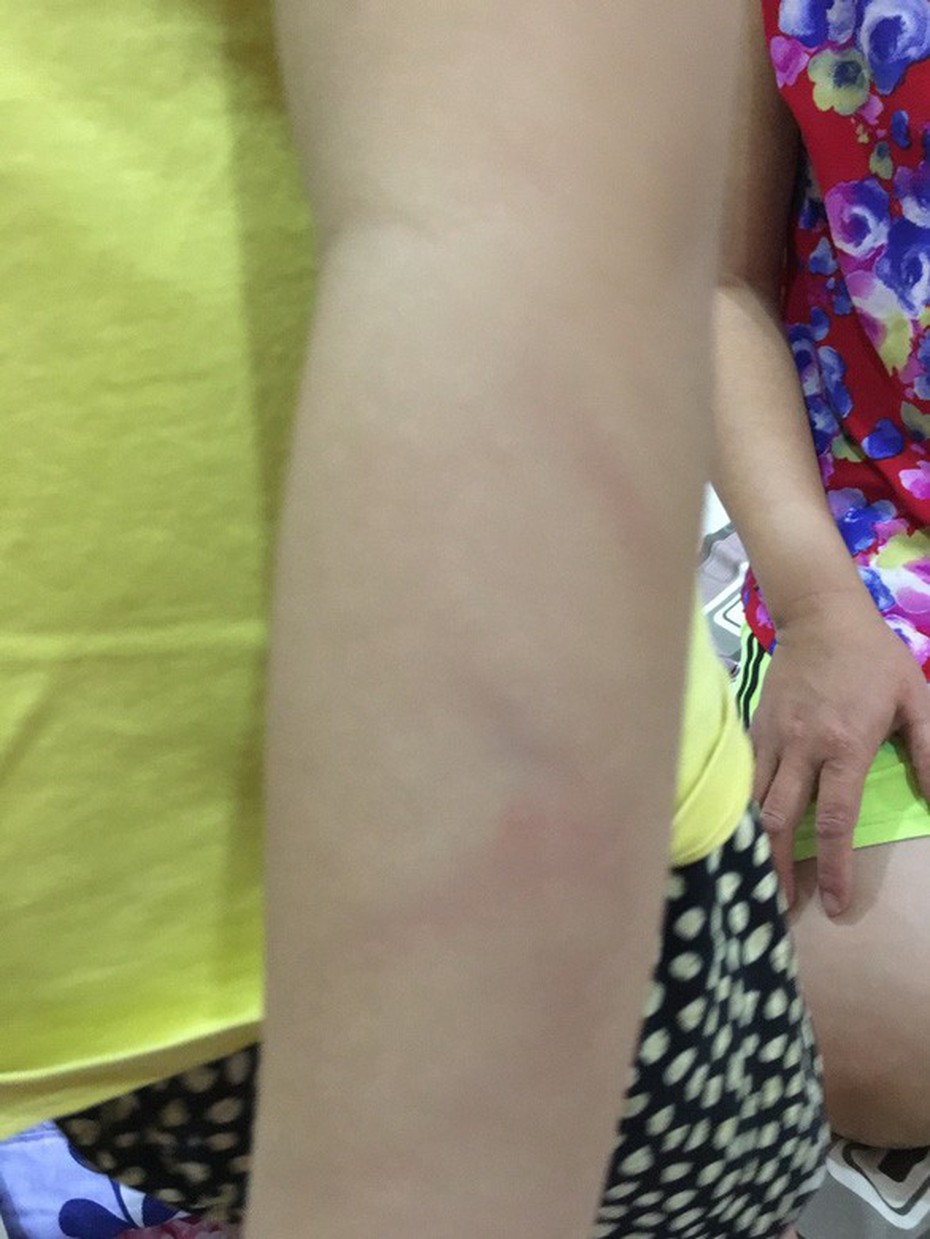 Con bị cô giáo đánh, phụ huynh có quyền đòi bồi thường 100 triệu đồng hay không?