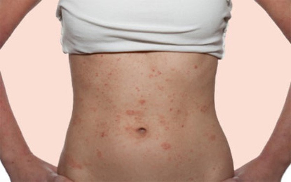 Sự thật về các loại hình giảm cân cấp tốc