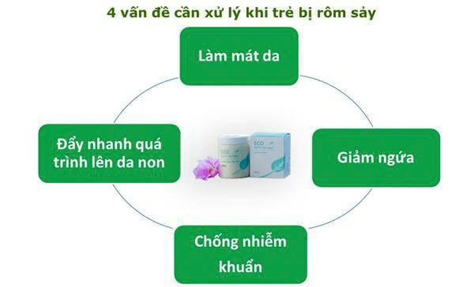 4 việc mẹ cần làm ngay khi con bị rôm sảy, mẩn ngứa