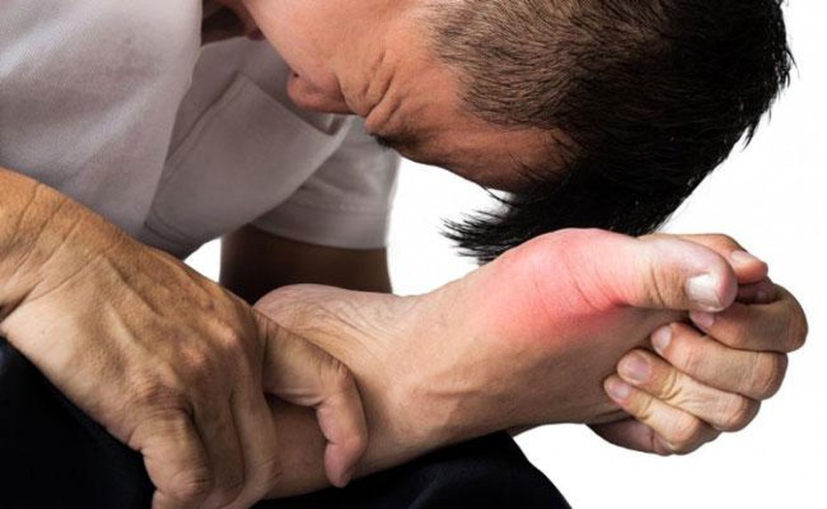 Bật mí bài thuốc chữa bệnh gout hiệu quả từ thảo dược