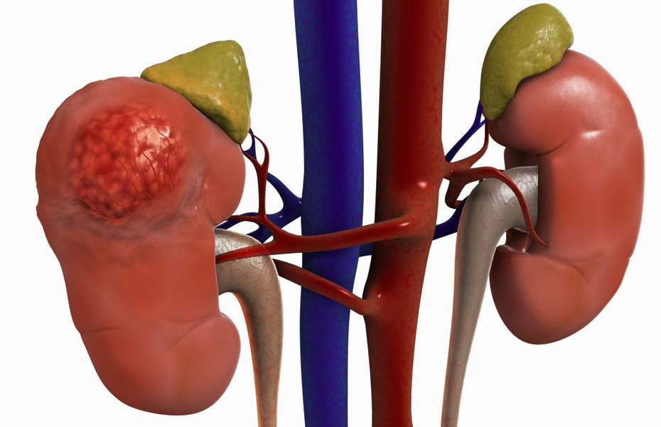 Hiểu rõ nguyên nhân để có biện pháp ngăn ngừa tiểu đêm ở người trung niên và cao tuổi?