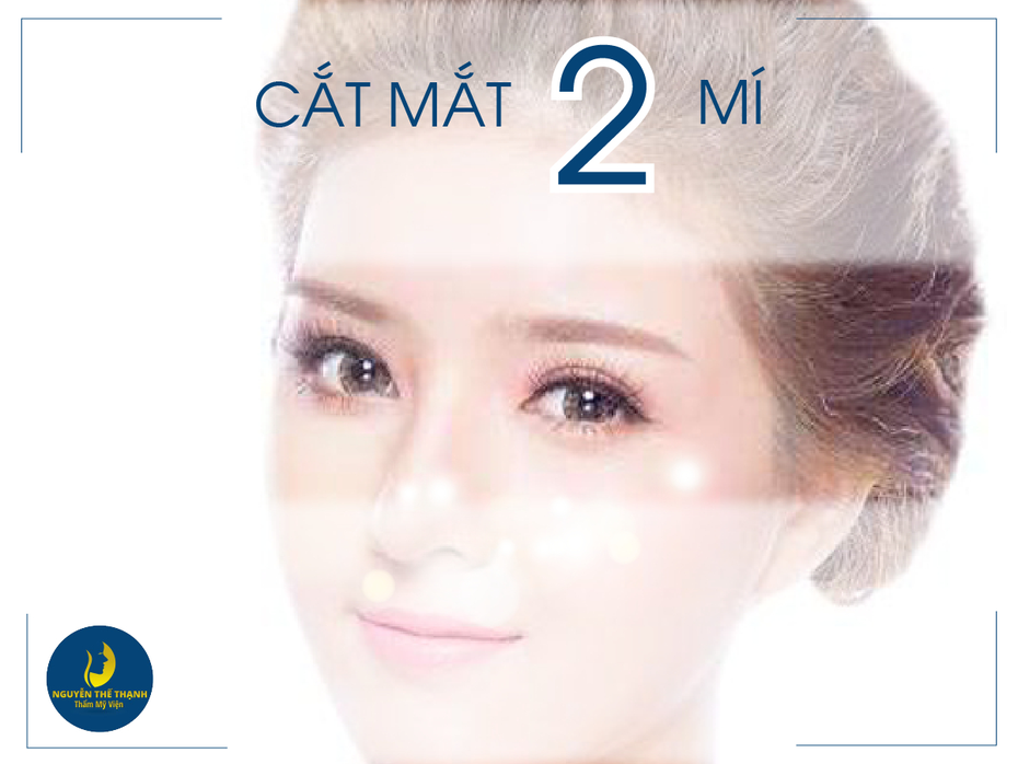 Cắt mắt 2 mí ở đâu đẹp?