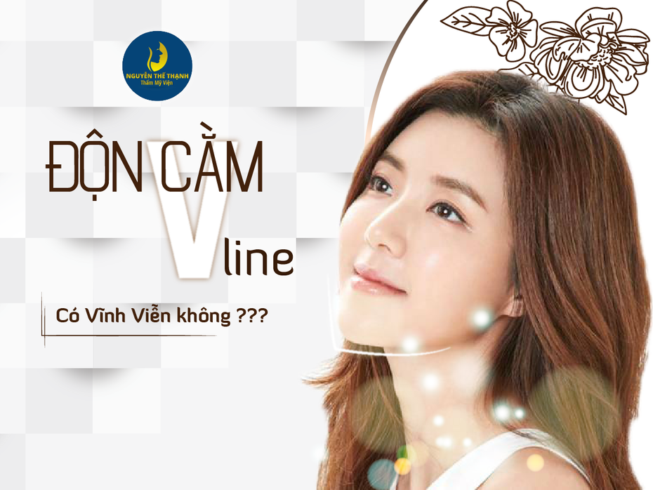 Độn cằm V-Line có được vĩnh viễn không?