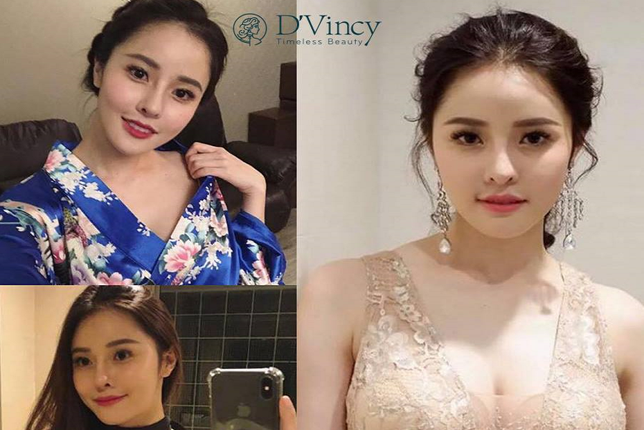 Điểm tên những dịch vụ thẩm mỹ hút khách đầu hè 2019