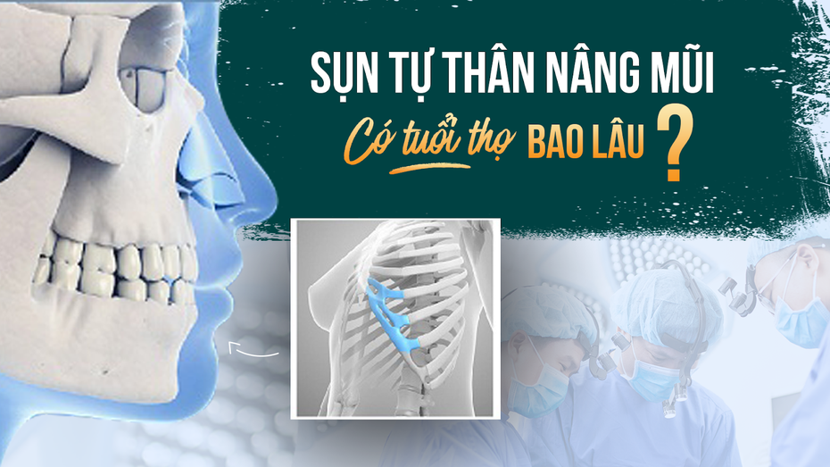 Nâng mũi sụn tự thân: Thực hư về phương pháp giúp tăng tuổi thọ của dáng mũi