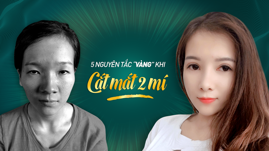 5 nguyên tắc "vàng" cắt mắt 2 mí nhất định bạn phải biết