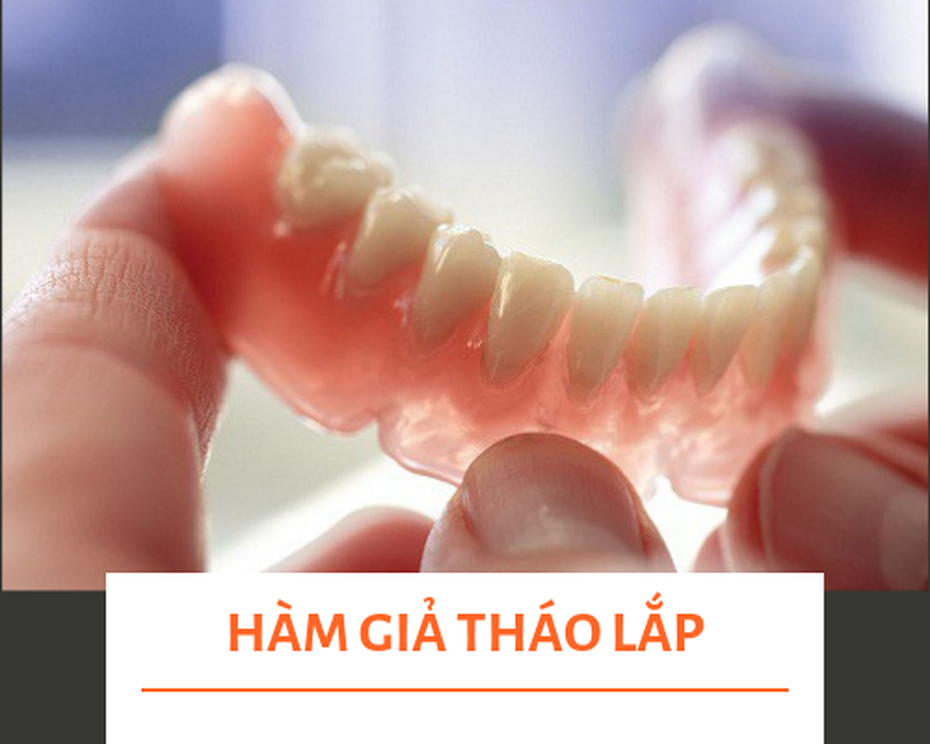 Răng không mọc được toàn hàm là bệnh gì? Chữa như thế nào?