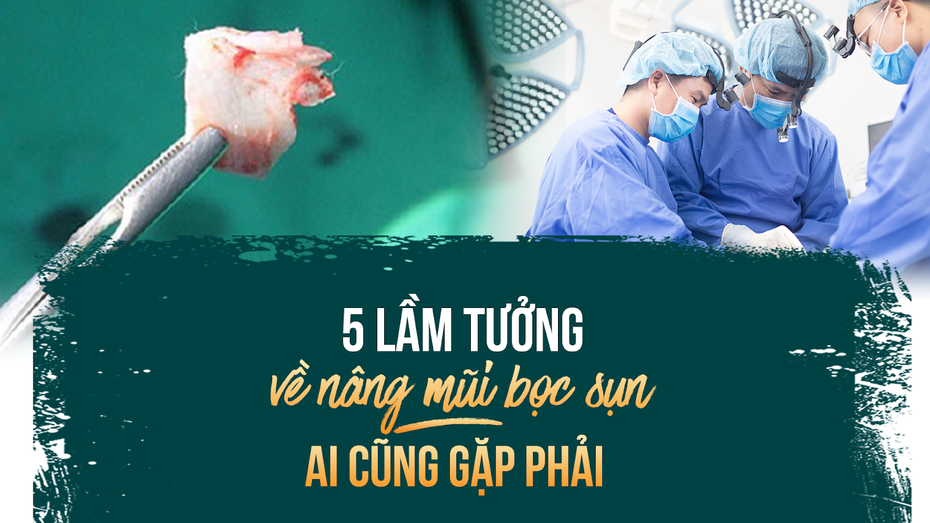 5 lầm tưởng về nâng mũi bọc sụn ai cũng gặp phải