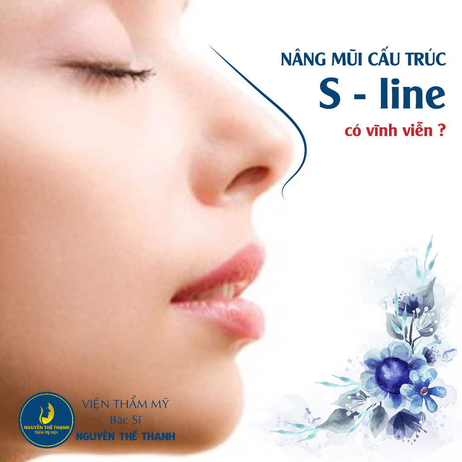 Nâng mũi cấu trúc Sline có vĩnh viễn không?