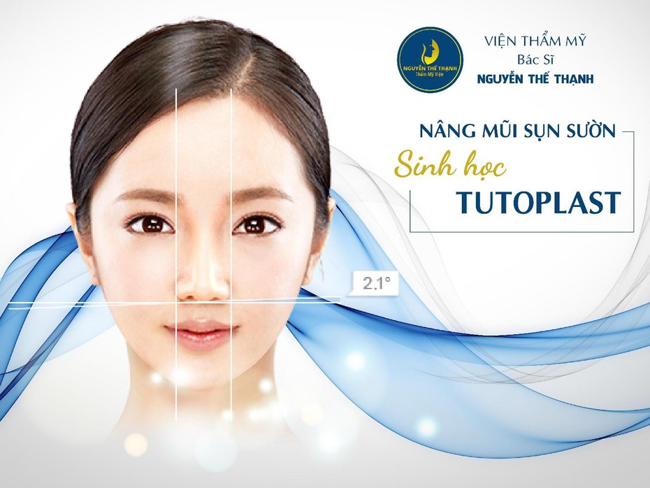 Nâng mũi sụn sườn sinh học Tutoplast - Bước đột phá trong công nghệ nâng mũi