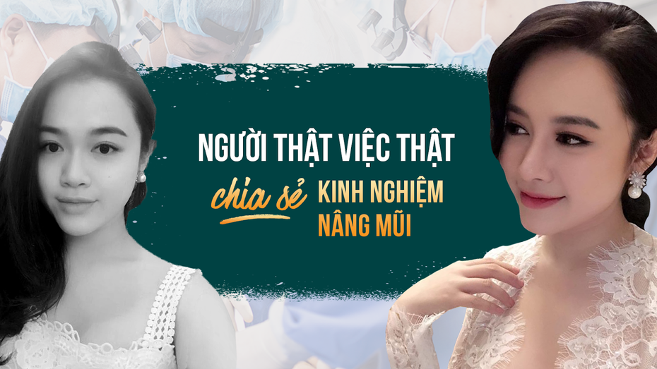 Kinh nghiệm “xương máu” khi đi nâng mũi cấu trúc của cô nàng 9x