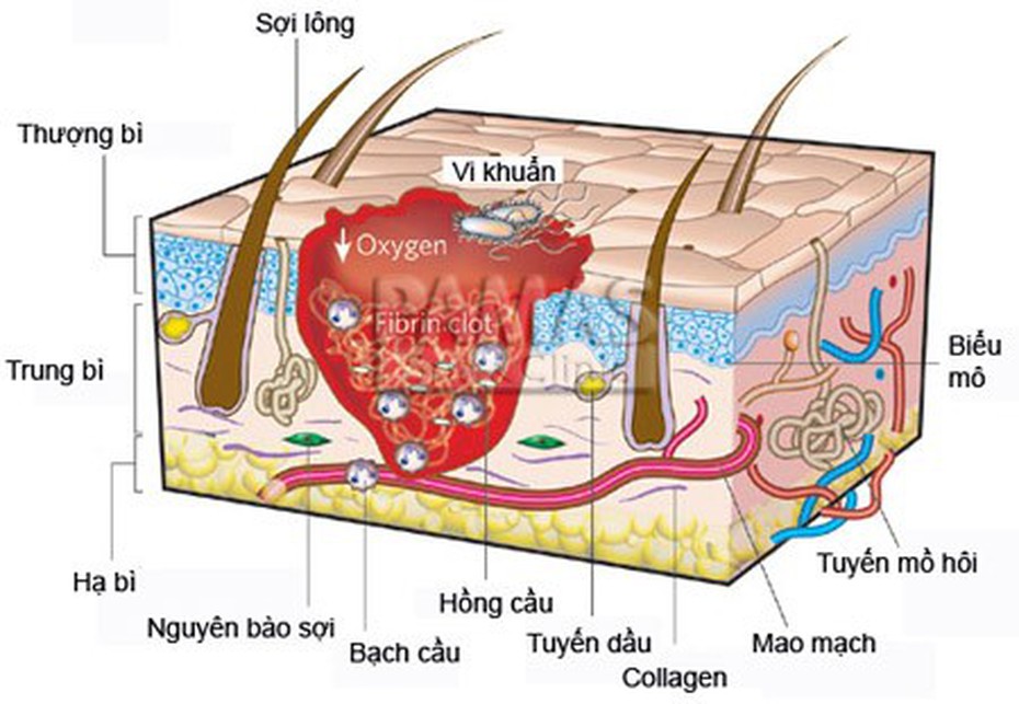 80% hôi nách liên quan đến di truyền