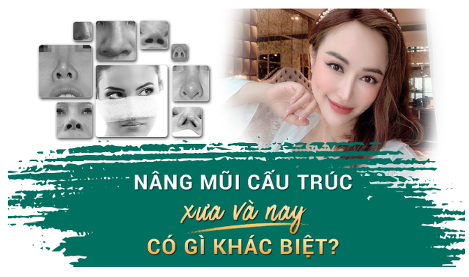 Nâng mũi cấu trúc XƯA và NAY có gì khác biệt?