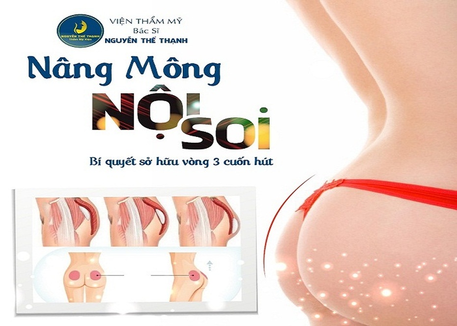 Nâng mông nội soi – Bí quyết sở hữu vòng 3 cuốn hút