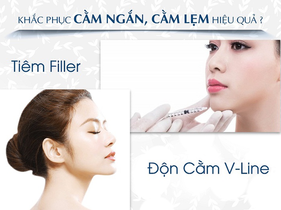 Những giải pháp nào khắc phục cằm ngắn, cằm lẹm hiệu quả?