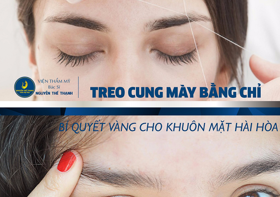 Treo cung mày bằng chỉ – Bí quyết vàng cho khuôn mặt hài hoà