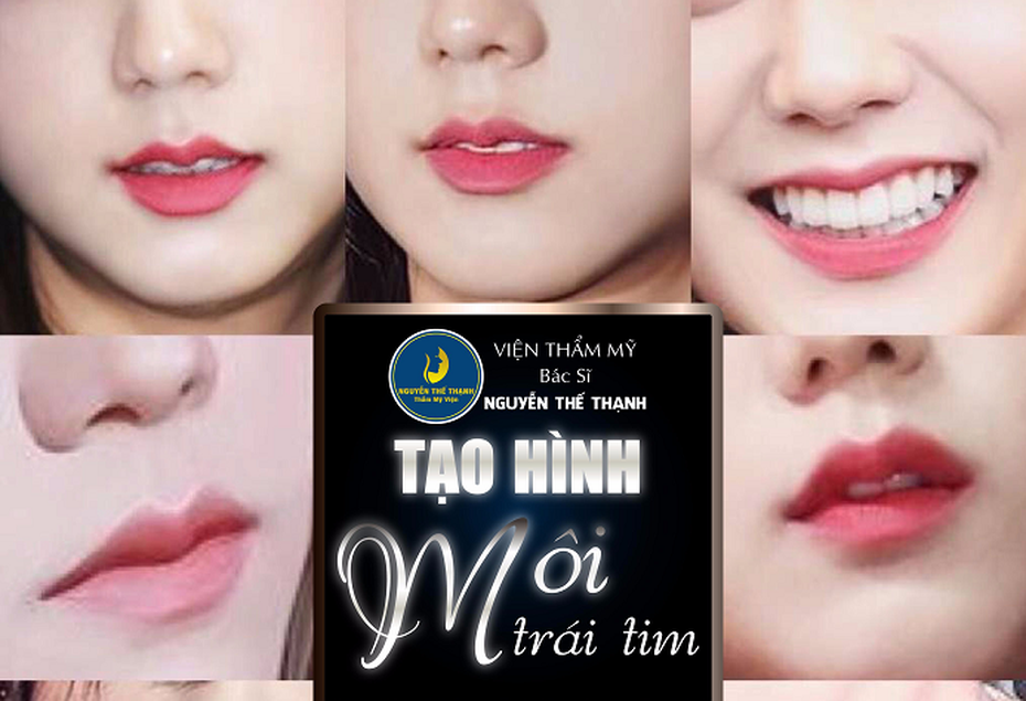 Tạo hình môi trái tim – Cho bờ môi thêm căng mọng quyến rũ