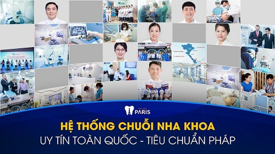 Niềng răng trả góp ở đâu tốt? Niềng răng trả góp chỉ từ 15 triệu đồng