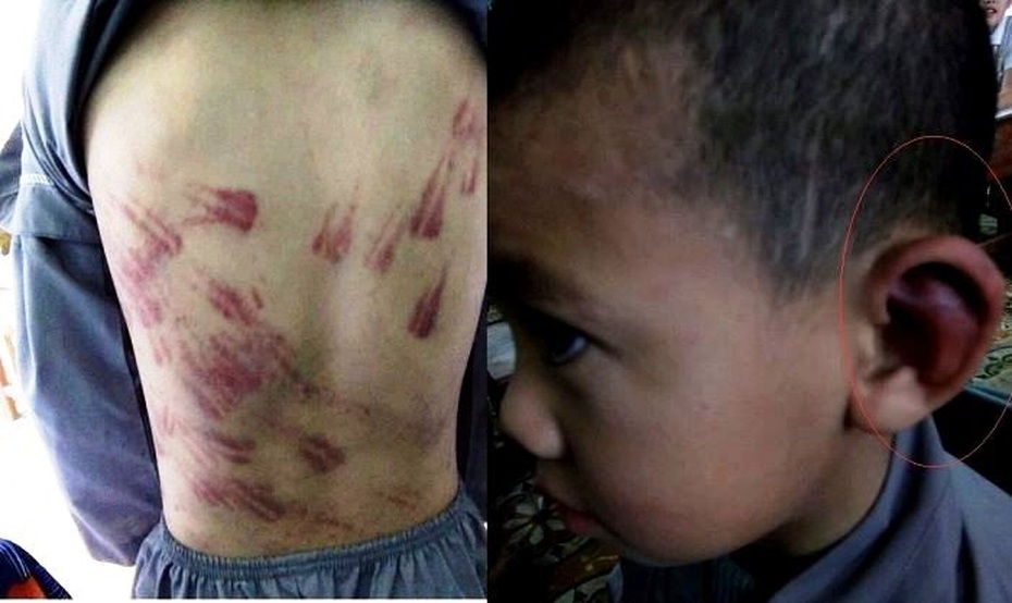 Đề nghị công an điều tra vụ trẻ mồ côi bị sư thầy bạo hành