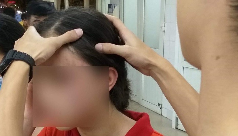 Hà Nội: Công an làm rõ vụ nữ sinh lớp 9 tố bị mẹ kế bạo hành dã man