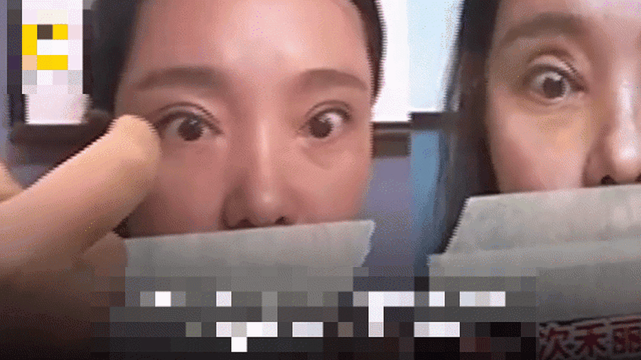 Video: Cô gái không thể nhắm mắt sau khi phẫu thuật cắt mí