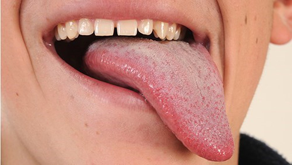 Lời xin lỗi của một cái lưỡi