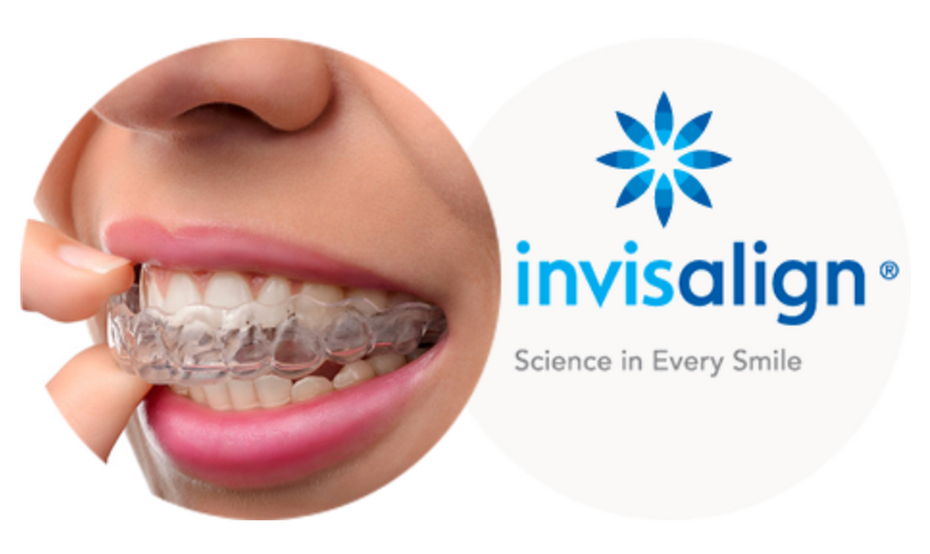 Chỉnh nha Invisalign – niềng răng vô hình, hoàn thiện nụ cười