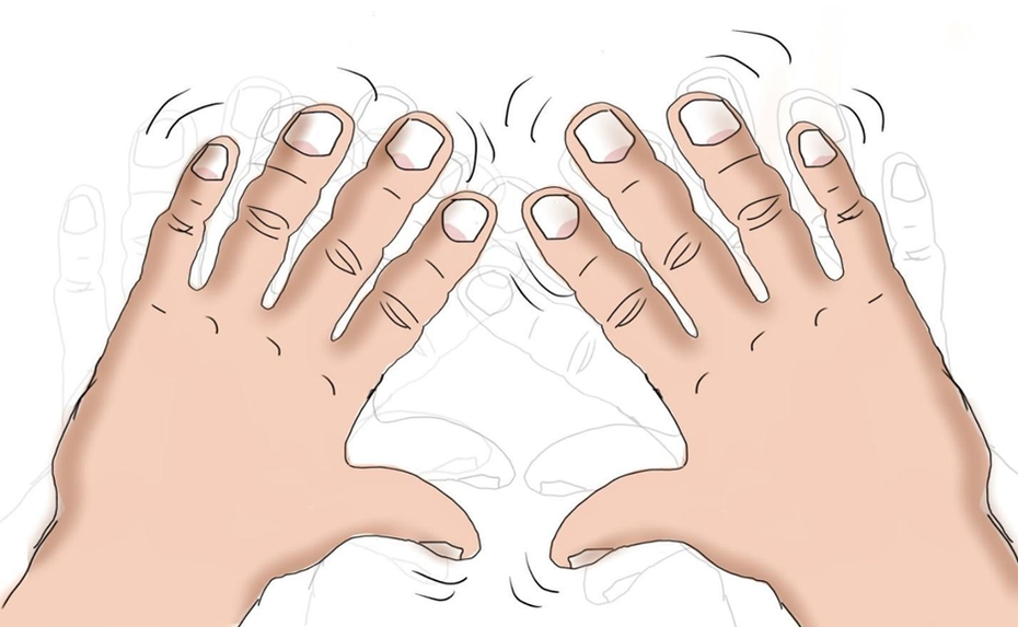 Đông dược giúp người bệnh run tay lấy lại tự tin trong cuộc sống