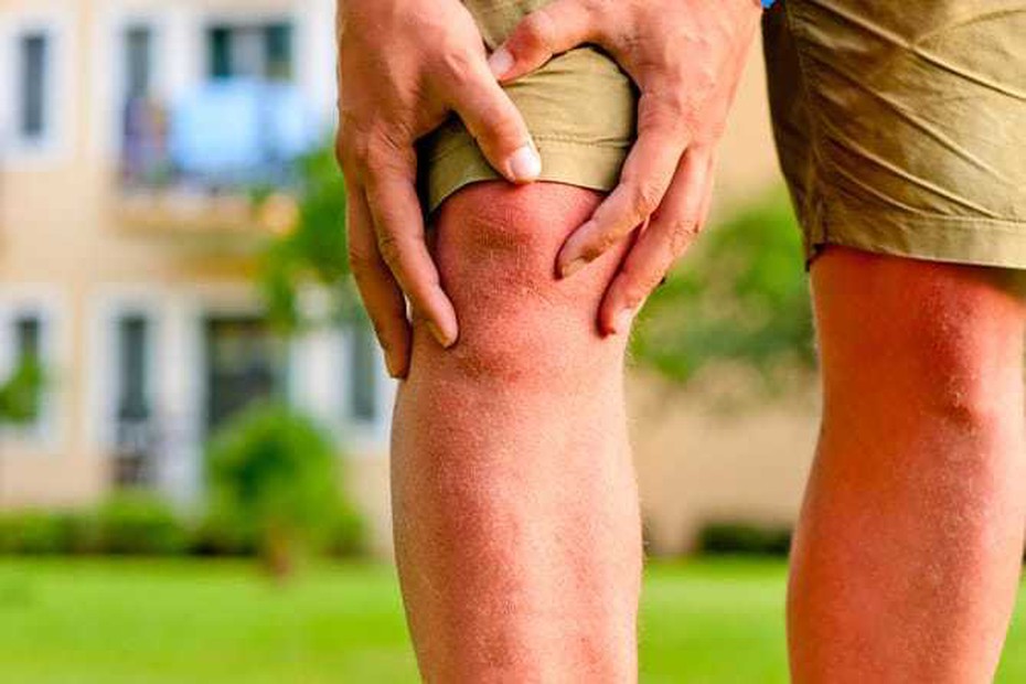 Những lưu ý khi lựa họn TPCN Khớp Nhất Vương hỗ trợ điều trị đau nhức xương khớp