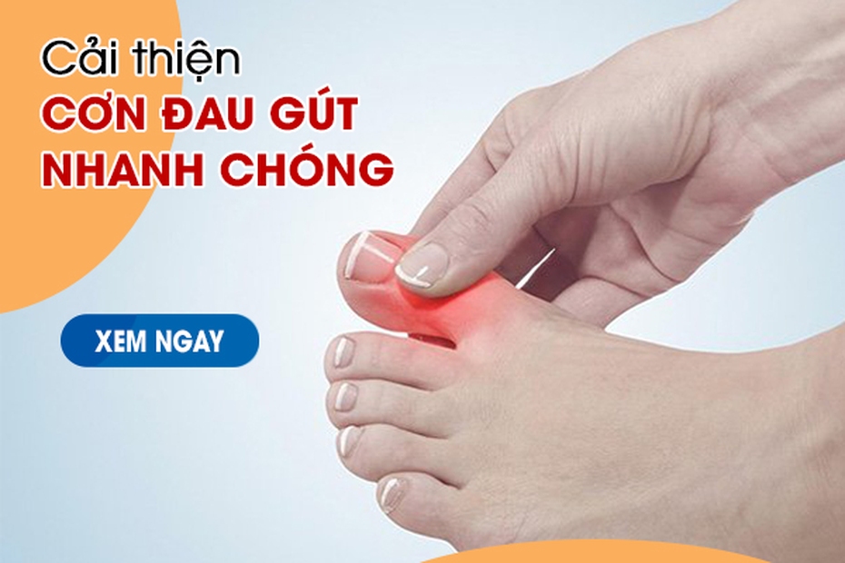 Cải thiện cơn đau gút nhanh chóng với Hoàng Thống Phong