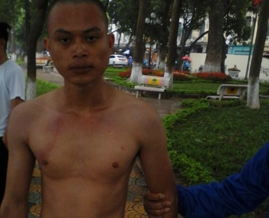 'Ngáo đá', nam thanh niên bơi ra tháp Rùa vì nghĩ là rái cá