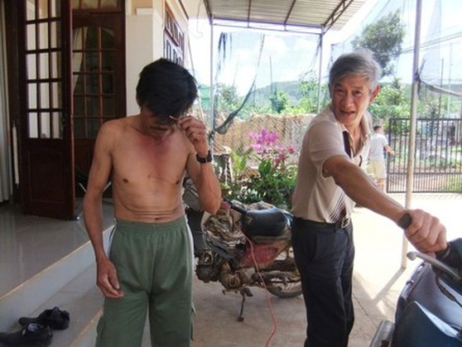 Sốc: 'Người nam châm' có thể để dòng điện 220V chạy qua