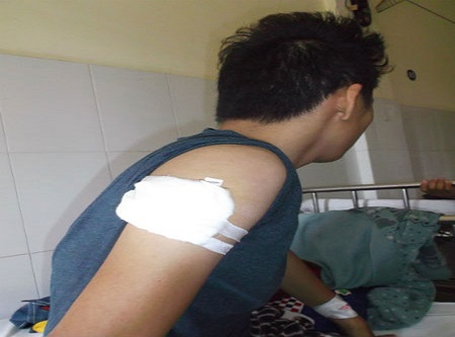 Bắt 'nữ quái' thuê giang hồ đâm người để trả thù