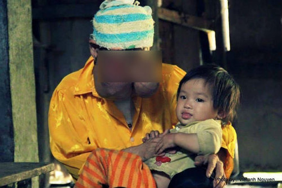 'Mẹ quái vật ơi, đừng chết'