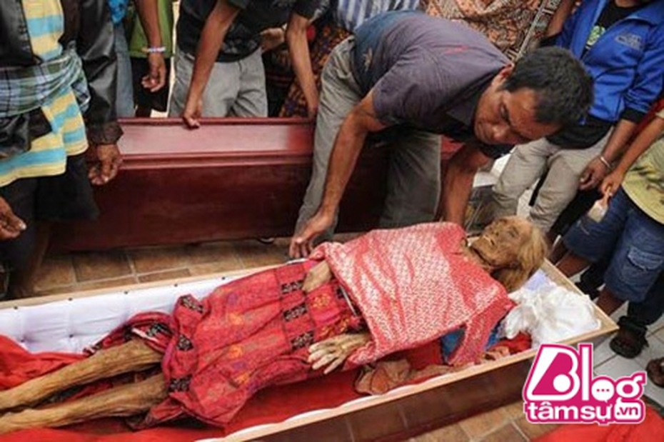 Kinh dị những trường hợp người chết sống lại trên thế giới