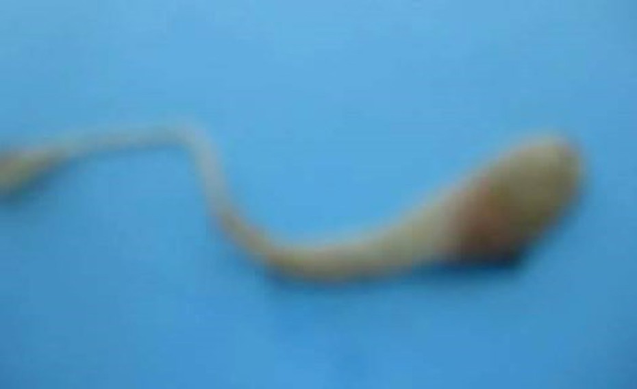 Trứng rắn có thể nằm trong lòng đỏ trứng gà hay không?