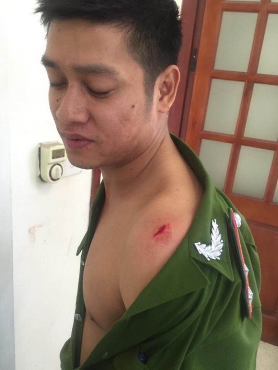 Khống chế đối tượng dùng rìu đe dọa người thân, chém công an