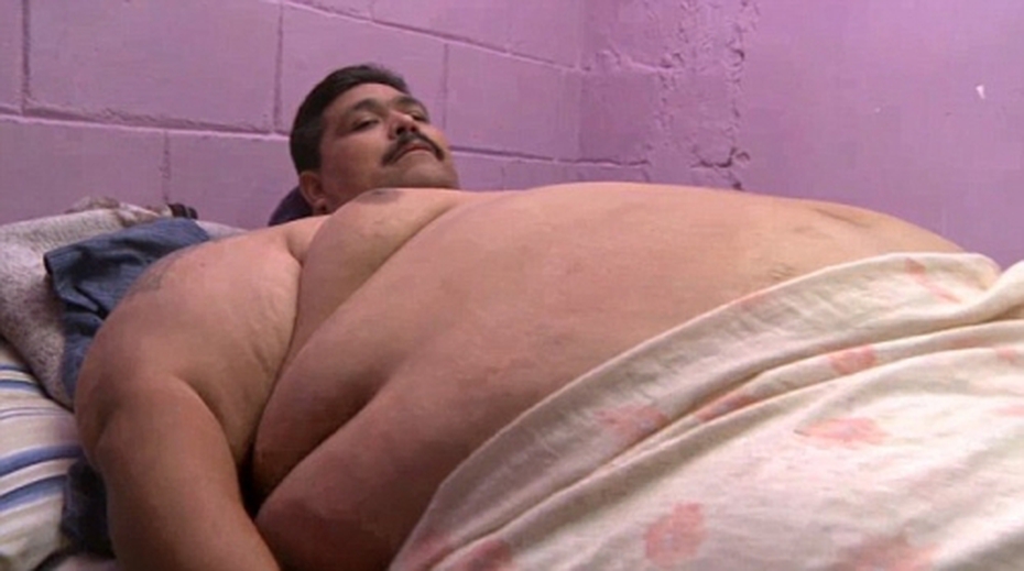 Người đàn ông béo nhất thế giới cắt 70% dạ dày để giảm cân