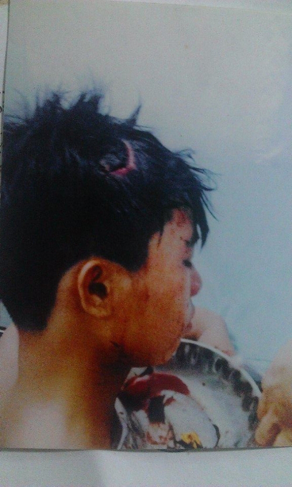 Nam Định: Vô tình ném vỏ khế... 'ăn' ngay cuốc xẻng