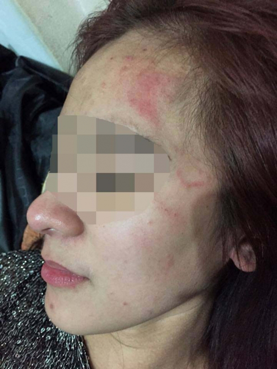 Thực hư chuyện cô gái 9x xinh đẹp tố chồng cũ bạo hành dù đã ly hôn